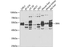 Western blot analysis of extracts of various cell lines, using IRF6 antibody  at 1:1000 dilution. (IRF6 Antikörper  (AA 115-300))
