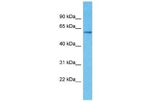 Host:  Rabbit  Target Name:  KLHL3  Sample Type:  Breast Tumor lysates  Antibody Dilution:  1. (KLHL3 Antikörper  (N-Term))