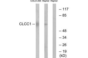 Western blot analysis of extracts from COLO cells and HepG2 cells, using CLCC1 antibody. (CLCC1 Antikörper  (Internal Region))