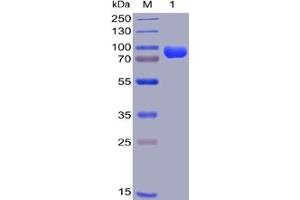 Human CD38, hFc-His Tag on SDS-PAGE under reducing condition. (CD38 Protein (Fc-His Tag))