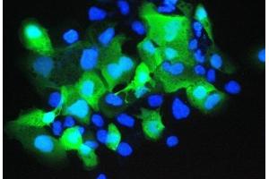 IF analysis of Psoriasin using anti-Psoriasin antibody (ABIN5692925). (S100A7 Antikörper  (AA 2-101))