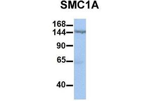 Host:  Rabbit  Target Name:  SMC1A  Sample Type:  Human HepG2  Antibody Dilution:  1. (SMC1A Antikörper  (C-Term))