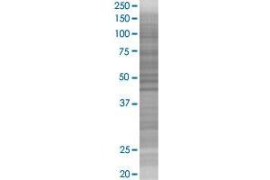 RPS6KB2 transfected lysate.