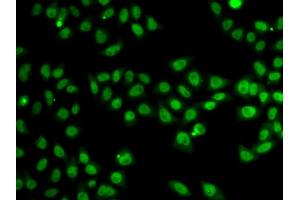 Immunofluorescence analysis of MCF-7 cells using SND1 antibody.