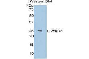 Western blot analysis of the recombinant protein. (PKC zeta Antikörper  (AA 404-591))
