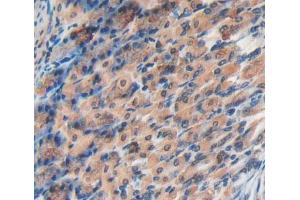 IHC-P analysis of stomach tissue, with DAB staining. (EPRS Antikörper  (AA 1007-1512))