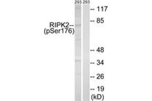 Western blot analysis of extracts from 293 cells treated with UV 15', using RIPK2 (Phospho-Ser176) Antibody. (RIPK2 Antikörper  (pSer176))