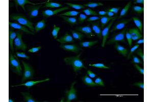 Immunofluorescence of purified MaxPab antibody to FLJ22662 on HeLa cell. (FLJ22662 (AA 1-223) Antikörper)