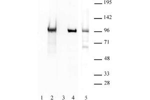 BORIS / CTCFL antibody (pAb) tested by Western blot. (CTCFL Antikörper  (N-Term))