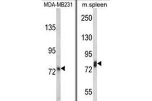 (LEFT) Western blot analysis of LTF Antibody in MDA-MB231 cell line lysates (35ug/lane). (Lactoferrin Antikörper)