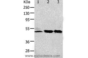 Western blot analysis of 293T and K562 cell, human fetal kidney tissue, using F2R Polyclonal Antibody at dilution of 1:650
