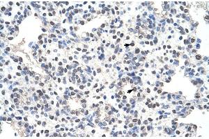 Rabbit Anti-NCL Antibody Catalog Number: ARP40583 Paraffin Embedded Tissue: Human Lung Cellular Data: Alveolar cells Antibody Concentration: 4. (Nucleolin Antikörper  (N-Term))
