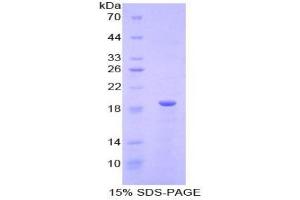 SDS-PAGE analysis of Mouse Relaxin Protein. (Relaxin Protein)