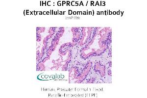 Image no. 1 for anti-G Protein-Coupled Receptor, Family C, Group 5, Member A (GPRC5A) (2nd Extracellular Domain) antibody (ABIN1735207) (GPRC5A Antikörper  (2nd Extracellular Domain))