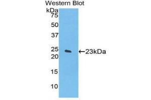 Western blot analysis of the recombinant protein. (SPTAN1 Antikörper  (AA 1950-2137))