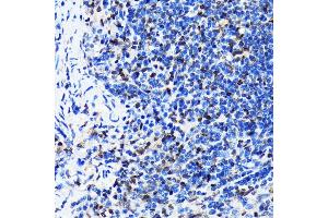 Immunohistochemistry of paraffin-embedded mouse spleen using HuR/EL antibody (ABIN7266913) at dilution of 1:100 (40x lens). (ELAVL1 Antikörper)