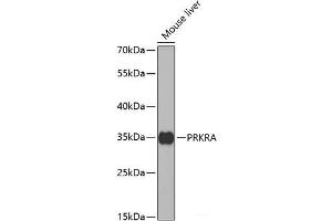 Western blot analysis of extracts of Mouse liver using PRKRA Polyclonal Antibody at dilution of 1:1000. (PRKRA Antikörper)