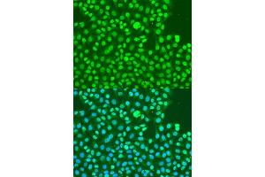 Immunofluorescence analysis of U2OS cells using Phospho-DNA-PKcs-S2056 antibody (ABIN6135292, ABIN6136206, ABIN6136207 and ABIN6225632) at dilution of 1:100. (PRKDC Antikörper  (pSer2056))