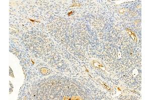 ABIN6256173 and ABIN6267231 at 1/100 staining Rat ovary tissue by IHC-P. (IKK-alpha /IKK-beta Antikörper  (pSer176, pSer177))