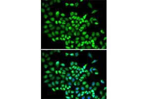 Immunofluorescence analysis of A-549 cells using Cullin 2 antibody (ABIN6129299, ABIN6139249, ABIN6139250 and ABIN6220930). (Cullin 2 Antikörper  (AA 40-310))