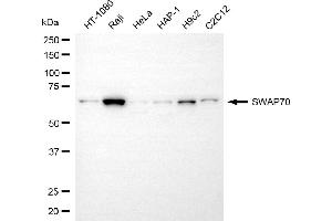 anti-SWAP Switching B-Cell Complex 70kDa Subunit (SWAP70) antibody