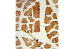 Formalin-fixed and paraffin-embedded human skeletal muscle reacted with BMI1 Antibody , which was peroxidase-conjugated to the secondary antibody, followed by DAB staining. (BMI1 Antikörper  (C-Term))
