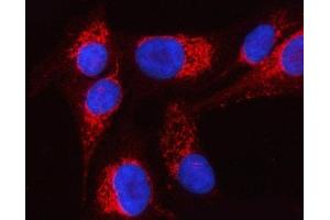 IF analysis of PTPIP51/RMDN3 using anti-PTPIP51/RMDN3 antibody (ABIN7601775). (RMDN3 Antikörper  (AA 45-438))