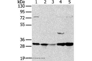 Western blot analysis of 293T and MCF7 cell, mouse brain tissue and K562 cell, mouse bladder tissue, using TPD52L2 Polyclonal Antibody at dilution of 1:400 (TPD52L2 Antikörper)