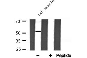 Western blot analysis of ARMC6 expression in Rat muscle lysate (ARMC6 Antikörper  (C-Term))