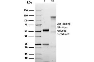 SDS-PAGE Analysis Purified S100B Recombinant Rabbit Monoclonal Antibody (S100B/1706R). (Rekombinanter S100B Antikörper)