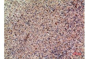 Immunohistochemistry (IHC) analysis of paraffin-embedded Human Liver, antibody was diluted at 1:100. (XCL1 Antikörper  (Internal Region))