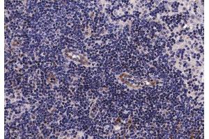 ABIN6267261 at 1/200 staining human lymph node tissue sections by IHC-P.