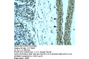 Human Smooth Muscle (HOXD12 Antikörper  (N-Term))