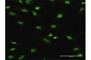 Immunofluorescence of purified MaxPab antibody to ATF1 on HeLa cell. (AFT1 Antikörper  (AA 1-271))