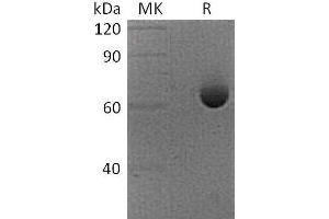 Western Blotting (WB) image for 5'-Nucleotidase, Ecto (CD73) (NT5E) protein (His tag) (ABIN7320977)
