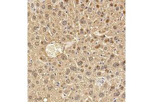 Immunohistochemistry of paraffin embedded mouse liver using Regucalcin (ABIN7075393) at dilution of 1:700 (300x lens)