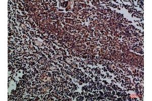 Immunohistochemical analysis of paraffin-embedded Human-tonsil, antibody was diluted at 1:100 (KIR2DL5A Antikörper  (AA 31-80))