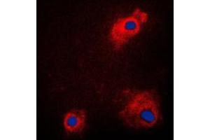 Immunofluorescent analysis of GSK3 alpha (pS21) staining in PC12 cells. (GSK3 alpha Antikörper  (N-Term, pSer21))