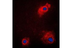 Immunofluorescent analysis of GSK3 alpha (pS21) staining in PC12 cells.