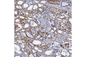IHC analysis of SBP/SELENBP1 using anti-SBP/SELENBP1 antibody (ABIN7600755). (SELENBP1 Antikörper  (AA 23-462))