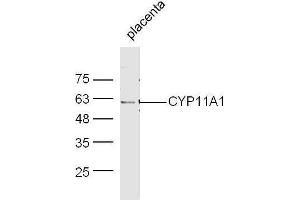 Mouse placenta lysates probed with Rabbit Anti-CYP11A1 Polyclonal Antibody, Unconjugated  at 1:500 for 90 min at 37˚C. (CYP11A1 Antikörper  (AA 321-420))