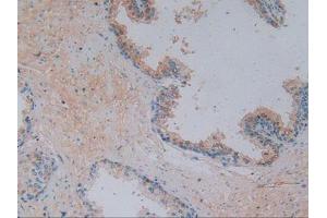 IHC-P analysis of Human Prostate Gland Tissue, with DAB staining. (Vitamin D-Binding Protein Antikörper  (AA 209-401))