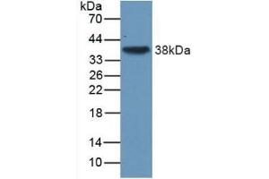 Detection of Recombinant TGFb3, Human using Monoclonal Antibody to Transforming Growth Factor Beta 3 (TGFb3) (TGFB3 Antikörper  (AA 24-300))