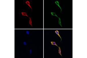 ABIN7093861 and ABIN7097904 staining Hela cells by IF/ICC.