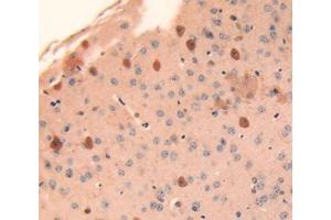 IHC-P analysis of brain tissue, with DAB staining. (Cathepsin L Antikörper  (AA 18-113))