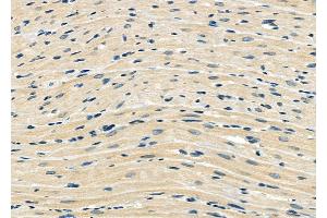ABIN6265329 and ABIN6273169 at 1/100 staining Rat heart tissue by IHC-P.