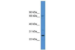 SLC13A3 antibody used at 0. (SLC13A3 Antikörper  (C-Term))