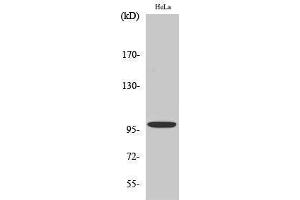 Western Blotting (WB) image for anti-Catenin-alpha E/N (C-Term) antibody (ABIN3183680) (Catenin-alpha E/N (C-Term) Antikörper)