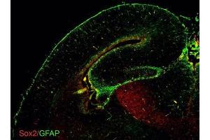 IHC-Fr Image GFAP antibodies detects GFAP proteins on embryonic mouse brain by immunohistochemical analysis. (GFAP Antikörper)