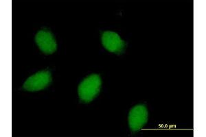Immunofluorescence of purified MaxPab rabbit antibody to CALB1 on HeLa cell. (CALB1 Antikörper  (AA 1-261))